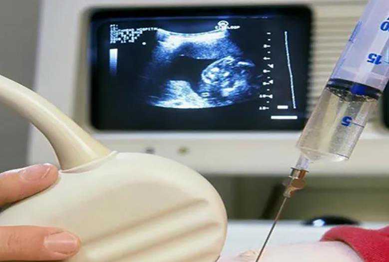 乌克兰代生男娃多少钱_试管婴儿保存生育能力技术为大龄女性卵子保鲜